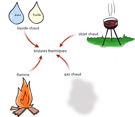 brulure-thermique
