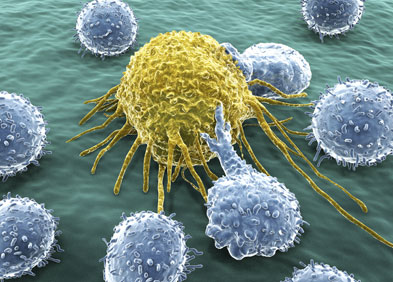 Cancer les diff rents types de cancers et leurs sympt mes
