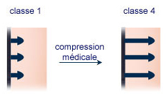 varice - compression médicale 