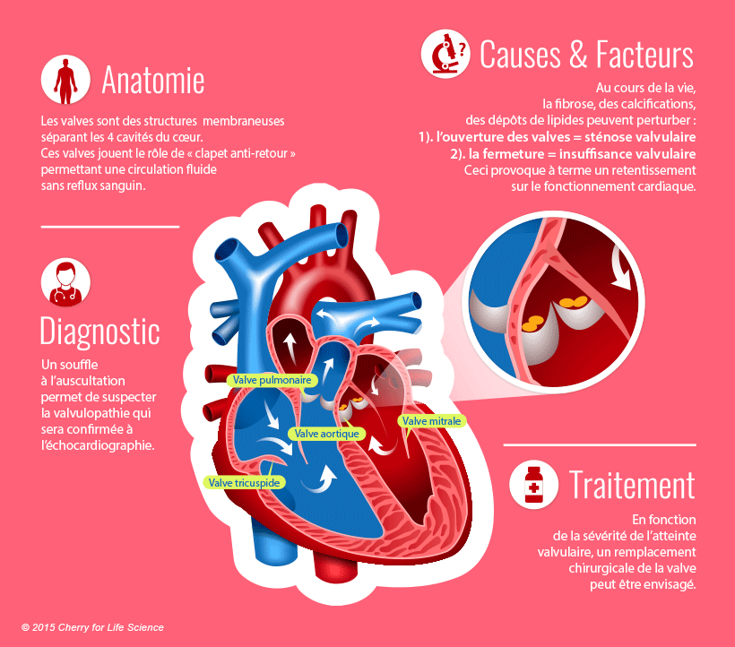 Les valves cardiaques