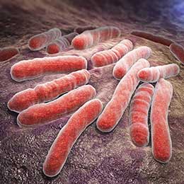Infection bactérienne tuberculose