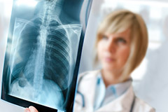 radiographie du thorax