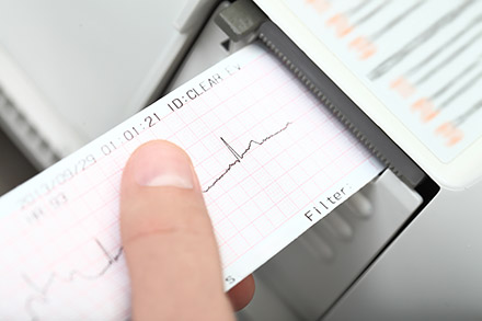 électrocardiogramme