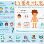 Infographie : érythème infectieux ou mégalérythème ou la 5ème maladie Infographie : érythème infectieux ou mégalérythème ou la 5ème maladie