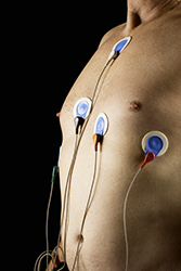 Holter cardiaque