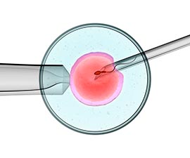 fécondation in vitro
