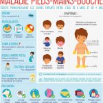 Infographie : maladie pieds-mains-bouche Infographie : maladie pieds-mains-bouche