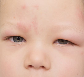 Www Sante Sur Le Net Com 21 06 28t07 46 51 00 00 Www Sante Sur Le Net Com Wp Content Uploads 18 02 17 08 Couverture Facebook Jpg Sante Sur Le Net Sante Sur Le Net Www Sante Sur Le Net Com Wp Content Uploads 11 Www Sante Sur Le Net Com 21 06 28t07 46 51 00 00 Www Sante Sur Le Net Com Wp Content Uploads 18 02 17 08 Couverture Facebook Jpg Sante Sur Le Net Sante Sur Le Net Www Sante Sur Le Net Com Wp Content Uploads 11