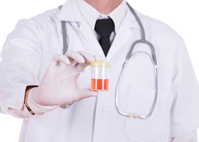 cancer vessie urine