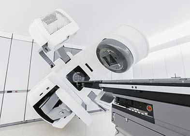 radiotherapie