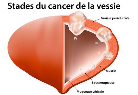 Résultat de recherche d'images pour 