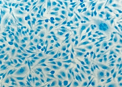 Examen anatomo-pathologique