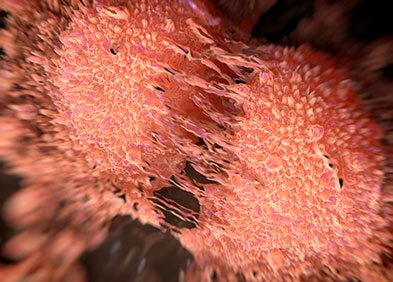 cancer voies aerodigestives superieures