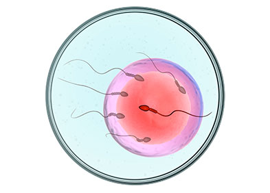 fecondation in vitro