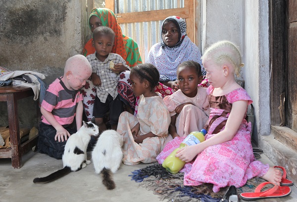 albinisme afrique