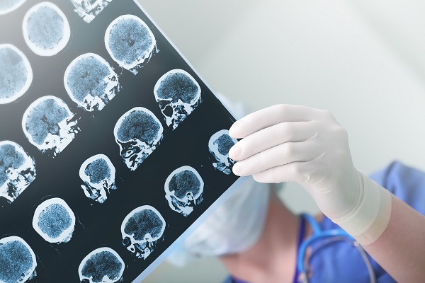 Bilan radiologique
