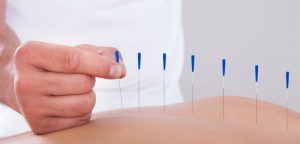 L’acupuncture a-t-elle sa place aux urgences ?