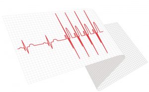 Electrocardiogramme