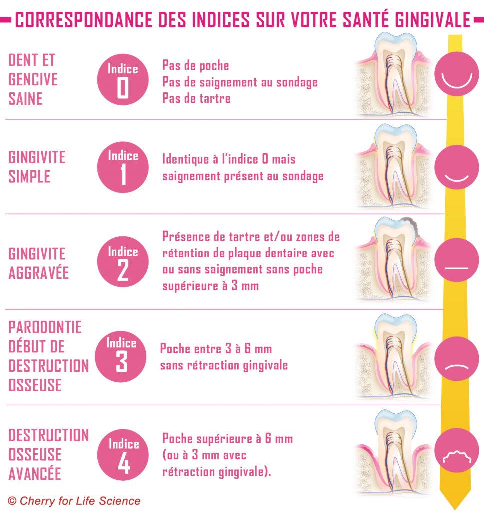 Correspondance des indices sur votre santé gingivale
