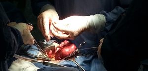 Le cochon, une source intarissable pour le don d’organes ?