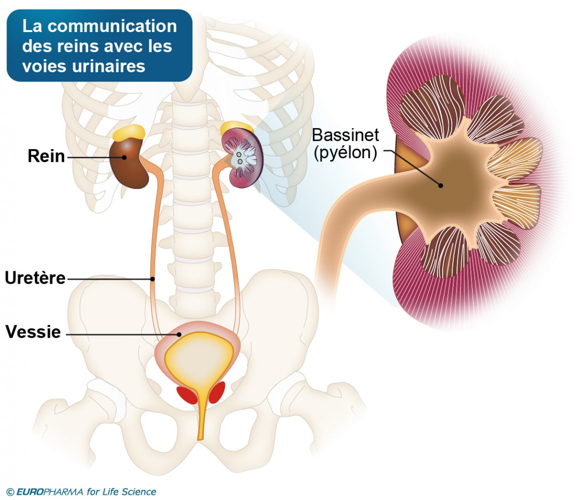 Pyélonéphrite définition médicale
