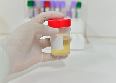 analyse d'urines