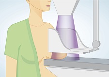 Déroulement de la mammographie