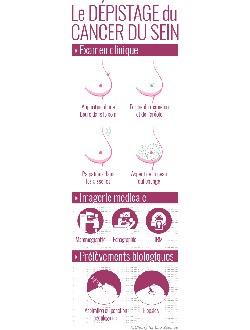 Cancer du sein : dépistage, facteurs de risque et traitements