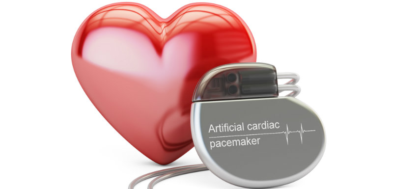 Vivre Avec Un Pacemaker Sante Sur Le Net