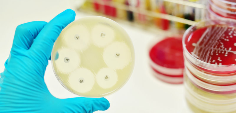 Nouveaux tests antibiorésistance