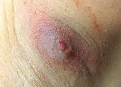 première dent anal sexe