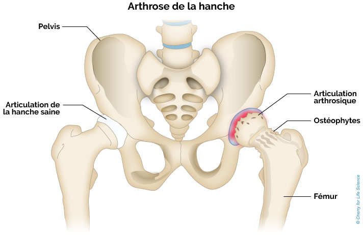 articulatii femur