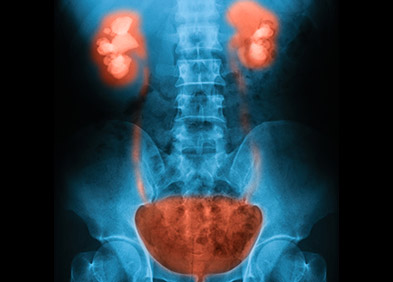 urographie permettant de voir l'appareil urinaire