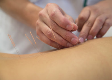 Qu’est-ce que l’acupuncture ?