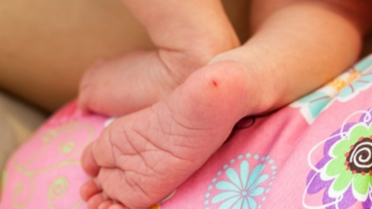 Test De Guthrie Depistage Precoce De 5 Maladies Rares Sante Sur Le Net L Information Medicale Au Cœur De Votre Sante Test De Guthrie Depistage Precoce De 5 Maladies Rares Sante Sur Le Net L Information Medicale Au Cœur De Votre Sante