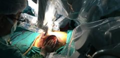 Des robots chirurgiens dans les blocs opératoires