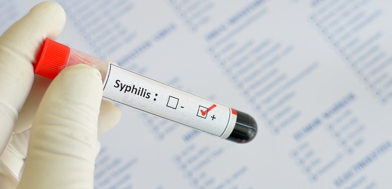 Le nombre de cas de syphilis a augmenté de 70% en Europe  