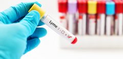 Maladie de Lyme : vers un nouveau diagnostic sanguin plus précis et plus rapide ?