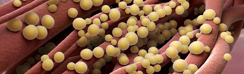 Infections à staphylocoques : définition - Santé sur le Net