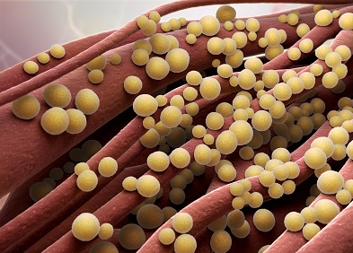 Infections à staphylocoques