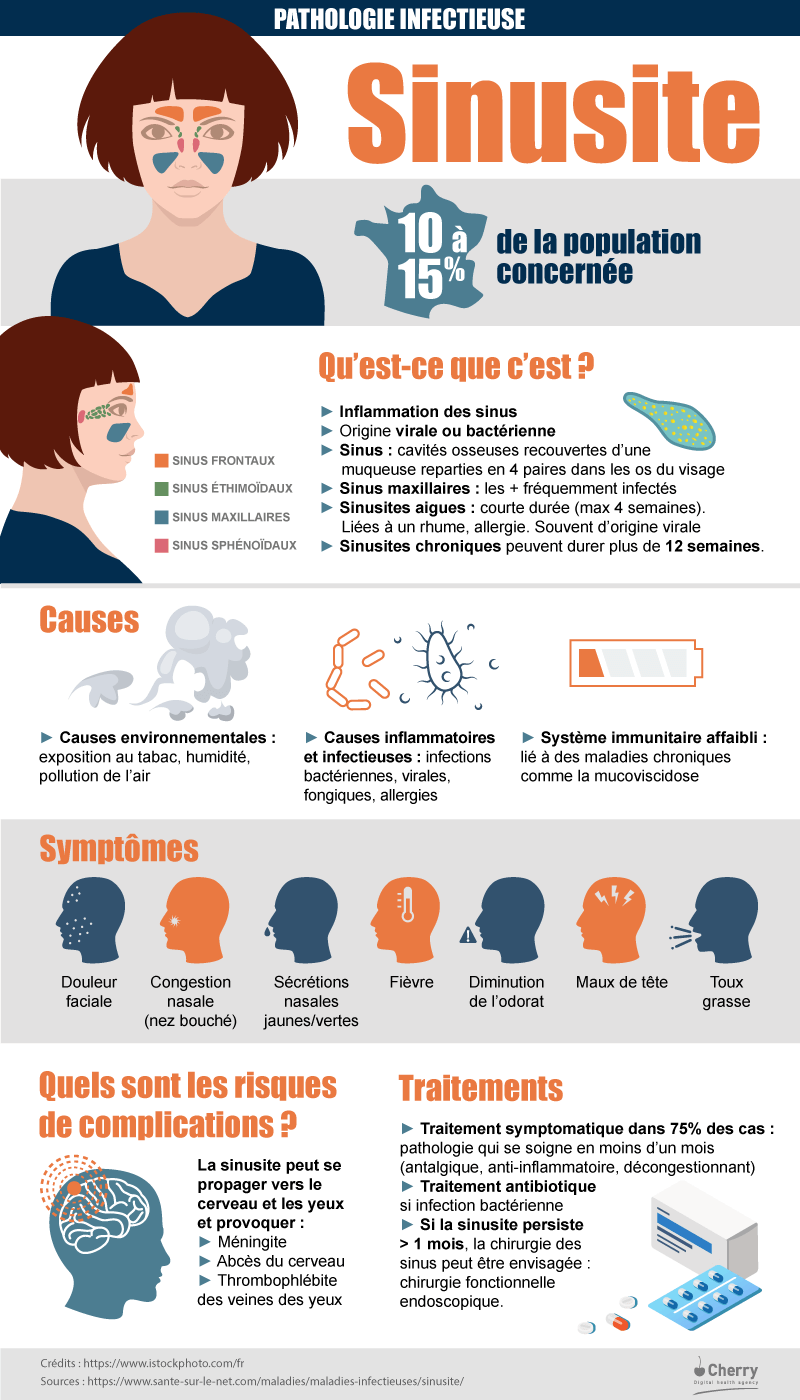 Sinusite : définition et traitements - Santé sur le Net