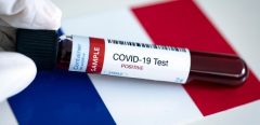 COVID-19 : Ce qu’il faut savoir sur les tests sérologiques