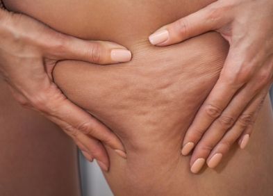 Dermatologie Tout Savoir Sur Les Problemes De Peau Muqueuse Ongles