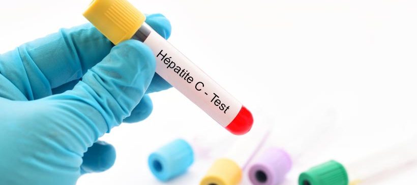 28 juillet 2020 : Journée Mondiale contre l’hépatite 28 juillet 2020 : Journée Mondiale contre l’hépatite