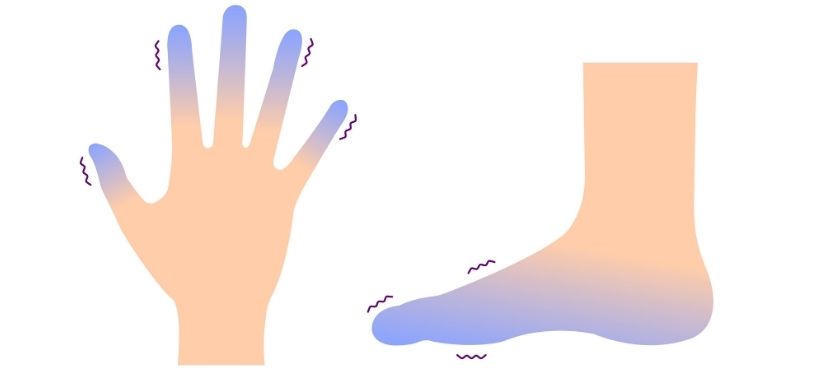 Illustration - engelures sur une main et un pied