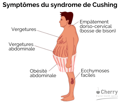 Vergetures : symptômes, traitement, définition 