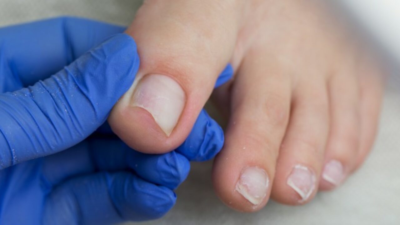 Ongles Qui Se Dedoublent Quelle Solution A Ce Probleme