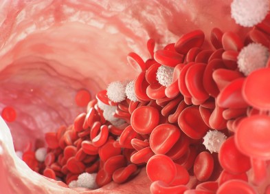 Thrombocytémie essentielle 