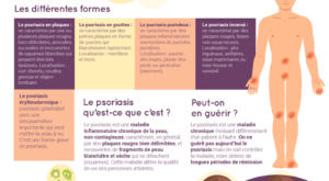 Infographie-psoriasis
