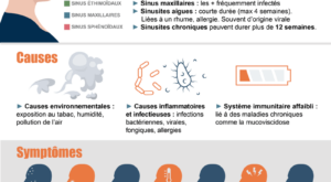 infographie-sinusite